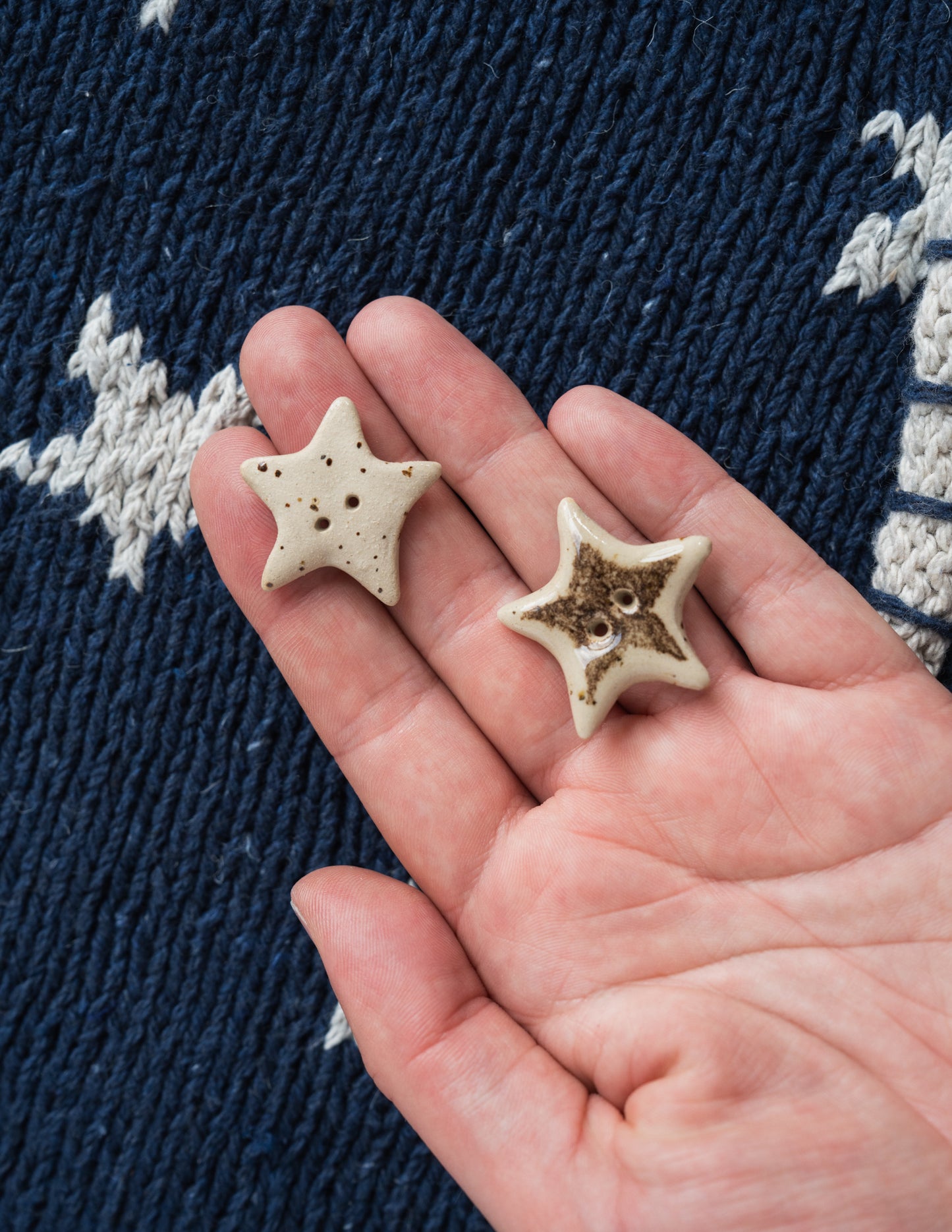 Star Buttons